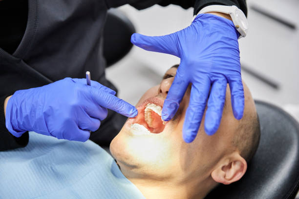 Best Broken or Chipped Tooth Repair in Long Prairie, MN